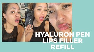 HYALURON PEN lip filler Refill TUTORIALresult [upl. by Assetak223]