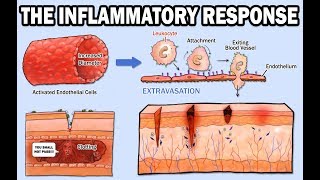 THE INFLAMMATORY RESPONSE [upl. by Misa]