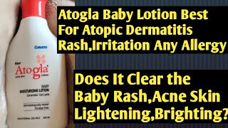 Atogla Baby Lotion Best for Atopic Dermatitis RashIrritationAllergyAcne Skin Lightening Whitening [upl. by Hammond]