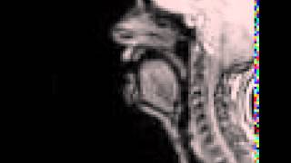 MRI voiceless alveolar affricate [upl. by Stilla]