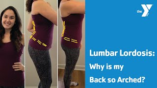 Lumbar Lordosis Why is my Back so Arched [upl. by Graaf92]