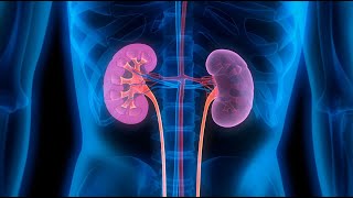 diabetic nephropathy [upl. by Negrom405]