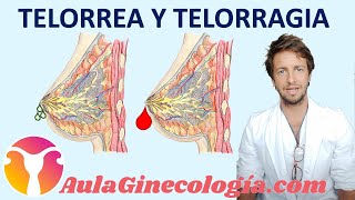 TELORREA SECRECIÓN POR EL PEZÓN y GALACTORREA causas y tratamiento  Ginecología y Obstetricia [upl. by Yrrol]