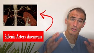 Splenic Artery Aneurysm [upl. by Macmahon]