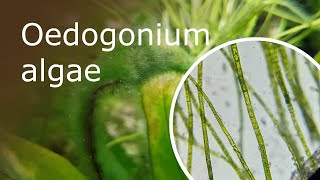 Oedogonium Algae Under a Microscope 100x1000x [upl. by Broome567]