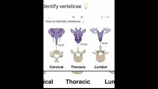 trick to remember vertebrae identification medicos Sudarshanlipane17 🩺🏥✨⛑️💫 [upl. by Godewyn502]