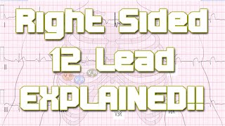 Right Sided 12 Lead Explained  Something In About 5 Minutes  Medic Materials [upl. by Carlisle103]