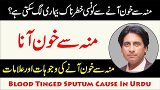 Moun se khoon ana  Khoon Thukna  Blood Tinged Sputum Cause In Urdu Dr Jahangir Yasir [upl. by Aramaj]