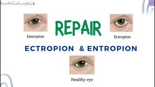 REPAIR ECTROPION amp ENTROPION CPT TOPICS MEDICAL CODING AND BILLING medicalcodercertified [upl. by Sinnard]