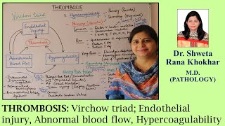 THROMBOSIS Virchow triad Endothelial injury Abnormal blood flow Hypercoagulability [upl. by Anitsrhc]