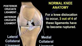 Knee Dislocations  Everything You Need To Know  Dr Nabil Ebraheim [upl. by Salisbury186]