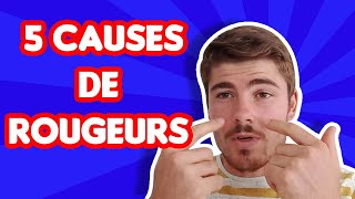 5 causes de rougeurs au visage [upl. by Sajet]