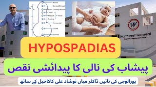 HYPOSPADIAS پیشاب کی نالی کا پیدائشی نقص پیشاب کرنے کا سراخ دوسرے جگہ پر ھونا B [upl. by Ibba]