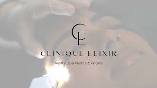 Carboxytherapie bij Clinique Elixir [upl. by Eiramasil]