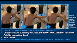 HOW TO ELIMINATE FOLDS IN UPPER TISSUES MLO PROJECTION [upl. by Ynehteb]