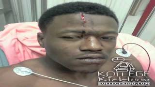 DCYoungFly Reveals How He Got Forehead Scar  kollegekidd [upl. by Desiree573]