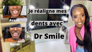 TRAITEMENT DR SMILE Dents du bonheur resserrer en 5mois gouttières invisibles prix douleurs [upl. by Keily432]