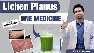 One Medicine To Cure Lichen Planus Skin Disease Naturally amp Permanent Results From First Week [upl. by Edda]