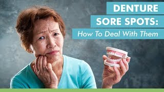 Denture Sore Spots How To Deal With Them [upl. by Tan]