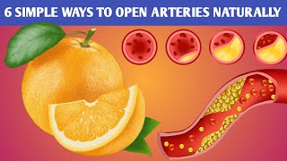 Best Ways To Open Arteries Naturally  Artery Blockage Removal Naturally  healthgems [upl. by Chastity756]