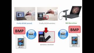 Video Otoscope Comparison [upl. by Aniv945]