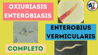 ENTEROBIASIS U OXIURIASIS  Enterobius vermicularis completo [upl. by Elsy]