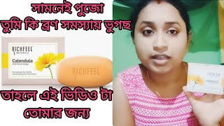 Richfeel anti acne soap honest reviewব্রণ সমস্যার সমাধান 😊🥰viralvideo babydiyavlog6465 [upl. by Othelia]