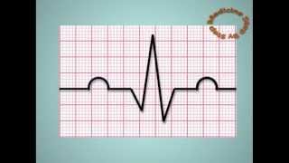 Understanding ECGs  EKG [upl. by Dode]