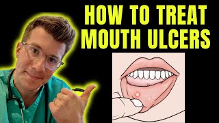 How to recognise and treat Mouth Ulcers getting rid of canker sores  Doctor ODonovan explains [upl. by Ellehcin]