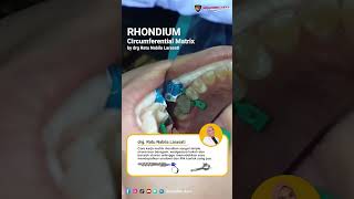 Circumferential Matrix Rhondium sudah dipakai banyak dokter❤️‍🔥 doktergigi dentalgigi [upl. by Croteau]