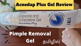 PRODUCT REVIEWEPI23ACNEDAP PLUS GEL REVIEWDAPSANE amp ADAPALENE GEL REVIEWPIMPLE REMOVAL GELACNE [upl. by Ahsienal]