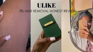 IPL AT HOME LASER HAIR REMOVAL  Final Review [upl. by Kurr]