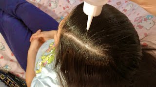 ASMR Scalp Massage Treatment w Coconut Oil  TEA RINSE w SQUEEZY SOUNDS OF A GLASS DROPPER 💆🏻‍♀️ [upl. by Elleoj]