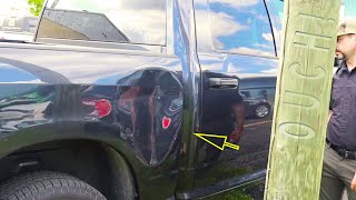 INSANE DENT PULL  Awesome Trick  Gnarly Bedside Dent [upl. by Nyrehtac457]