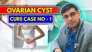 Ovarian Cyst Cure Case No  1 Homeopathy Treatment For Ovarian Cyst  Dr Abhik Ghosh Homeopathy [upl. by Anairt627]