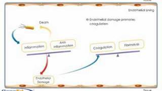 Sepsis development and progression [upl. by Idnyc318]