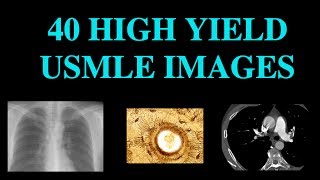 40 High Yield Images for USMLE CT XRay Histology [upl. by Sirah410]