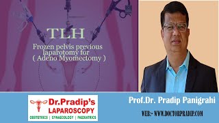 TLHFrozen Pelvis Previous Laparotomy forAdeno Myomectomylaparoscopicsurgeon video doctor [upl. by Zingg]