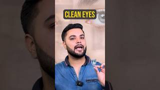 Puffy Eyes Eye Bags amp Dark Circles Treatment Solution for Brighter Eyes [upl. by Coffin]