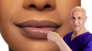 How to Plump Your Lips Naturally Dr Mandell [upl. by Virginie]