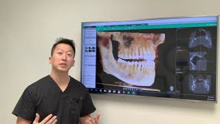 IV Sedation vs Oral Sedation [upl. by Tolley288]