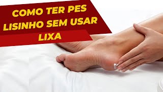 Como acabar com as rachaduras nos pés e deixar os pés macios GASTANDO MUITO POUCO [upl. by Ogires]