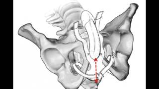 Incontinence urinaire de lhomme quels traitements [upl. by Fenelia948]