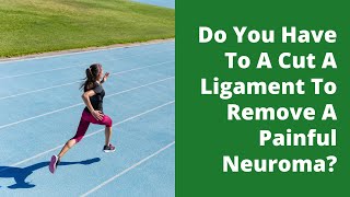 Do You Have To A Cut A Ligament To Remove A Painful Neuroma [upl. by Damalis]