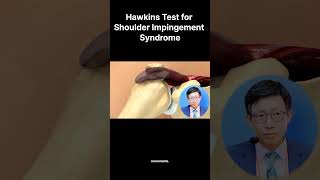 Hawkins Test for Shoulder Impingement Syndrome [upl. by Oecam]