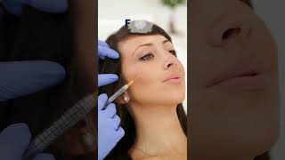 Confused About Botox and Fillers  Botox Treatment  Fillers Treatment  Skin Care  Skin Treatment [upl. by Aelem]