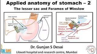 Lesser sac and foramen of Winslow  Applied anatomy of stomach part 2 [upl. by Rosio]