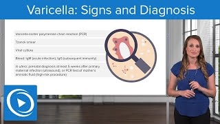 Varicella Signs and Diagnosis – Pediatric Nursing  Lecturio Nursing [upl. by Titos257]