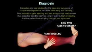 Compartment SyndromeDiagnosisPressuresFasciotomy Everything You Need To Know Dr Nabil Ebraheim [upl. by Renee]