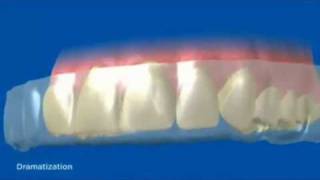 How Crest 3D Whitestrips Work [upl. by Dleifniw295]